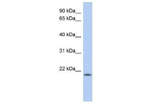 WB Suggested Anti-CHAC2 Antibody Titration: 0. (CHAC2 antibody  (N-Term))