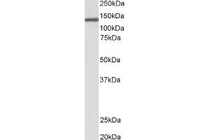 ABIN2564306 (0. (Oncostatin M Receptor antibody  (Internal Region))