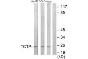 Western blot analysis of extracts from HepG2/COLO205/HeLa cells, using TCTP Antibody. (TPT1 antibody  (AA 71-120))