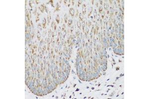 Immunohistochemistry of paraffin-embedded human esophagus using IGF2BP3 antibody. (IGF2BP3 antibody  (AA 300-579))