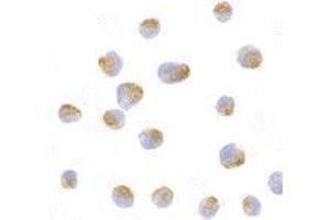 Immunocytochemistry of Bcl-B in Jurkat cells with AP30130PU-N Bcl-B antibody at 10 μg/ml. (BCL2L10 antibody  (N-Term))