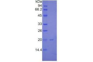 SDS-PAGE analysis of Human Renalase Protein.