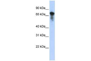 WB Suggested Anti-RHPN1 Antibody Titration: 0. (RHPN1 antibody  (Middle Region))