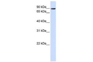 TMEM16K antibody used at 1 ug/ml to detect target protein.