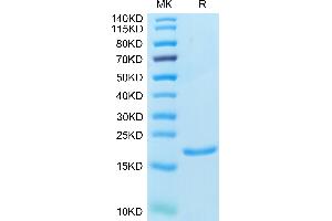 Human IL-1 alpha/IL-1A on Tris-Bis PAGE under reduced condition. (IL1A Protein (AA 113-271))