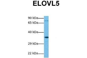 Host:  Rabbit  Target Name:  ELOVL5  Sample Tissue:  Human Jurkat  Antibody Dilution:  1. (ELOVL5 antibody  (N-Term))