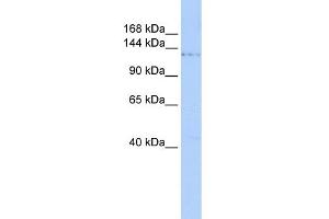 WB Suggested Anti-PHF2 Antibody Titration:  0. (PHF2 antibody  (Middle Region))