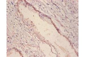 Immunohistochemistry of paraffin embedded human prostate tissue using ABIN7143879 at dilution of 1:100 (GLA antibody  (AA 32-429))