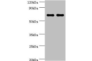 Western blot All lanes: BIRC2 antibody at 5 μg/mL Lane 1: HepG2 whole cell lysate Lane 2: K562 whole cell lysate Secondary Goat polyclonal to rabbit IgG at 1/10000 dilution Predicted band size: 70, 65 kDa Observed band size: 70 kDa