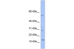 WB Suggested Anti-TD1 Antibody Titration: 0. (TLX1 Neighbor antibody  (Middle Region))