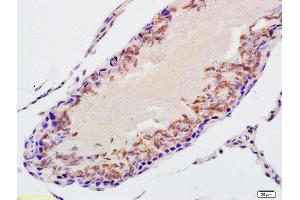 Formalin-fixed and paraffin embedded rat testis labeled with Rabbit Anti-STK31 Polyclonal Antibody, Unconjugated (ABIN721720) at 1:200 followed by conjugation to the secondary antibody and DAB staining (STK31 antibody  (AA 201-300))