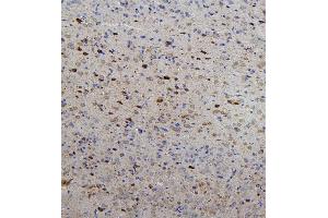 IHC analysis of RET using anti-RET antibody (ABIN6719502). (Ret Proto-Oncogene antibody  (AA 29-304))