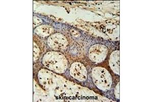 anti-Zinc Finger CCCH-Type Containing 3 (ZC3H3) (AA 920-948), (C-Term) antibody
