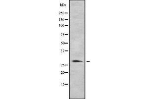 Western blot analysis of HLA-DRB1 using MCF7 whole cell lysates (HLA-DRB1 antibody)