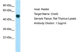 Host: Rabbit Target Name: Cnot3 Sample Type: Rat Thymus lysates Antibody Dilution: 1. (CNOT3 antibody  (Middle Region))