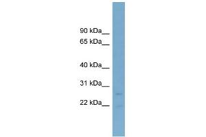 WB Suggested Anti-NT5M Antibody Titration: 0. (NT5M antibody  (Middle Region))