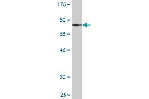 Western Blot detection against Immunogen (71. (PSTPIP1 antibody  (AA 1-416))