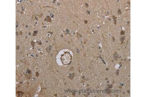 Immunohistochemistry of Human brain using MARK4 Polyclonal Antibody at dilution of 1:40 (MARK4 antibody)