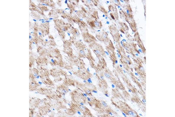 LATS2 antibody  (AA 1-100)