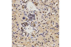 Immunohistochemistry (IHC) image for anti-Family with Sequence Similarity 160, Member B2 (FAM160B2) antibody (ABIN1872648) (FAM160B2 antibody)