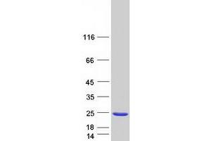 NudC Domain Containing 2 (NUDCD2) protein (Myc-DYKDDDDK Tag)