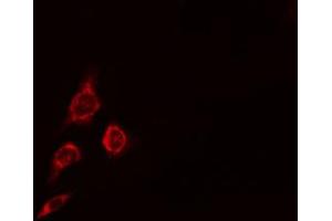 ABIN6274718 staining HepG2 cells by IF/ICC. (MRPS16 antibody)