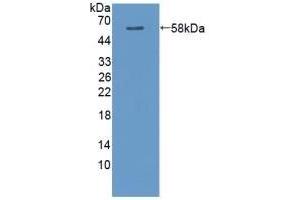 Detection of Recombinant CAMK2a, Rat using Polyclonal Antibody to Calcium/Calmodulin Dependent Protein Kinase II Alpha (CAMK2a) (CAMK2A antibody  (AA 1-478))