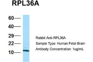Host: Rabbit  Target Name: RPL36A  Sample Tissue: Human Fetal Brain  Antibody Dilution: 1. (RPL36AL antibody  (C-Term))