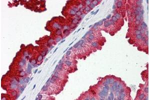 Human Prostate: Formalin-Fixed, Paraffin-Embedded (FFPE) (RAB23 antibody  (AA 35-84))