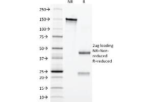 SDS-PAGE Analysis Purified Erythropoietin (EPO) Mouse Monoclonal Antibody (EPO/1367). (EPO antibody  (AA 28-162))