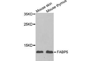 Western blot analysis of extracts of mouse skin and mouse thymus using FABP5 antibody. (FABP5 antibody)