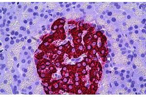 Human Pancreas, Islets of Langerhans: Formalin-Fixed, Paraffin-Embedded (FFPE) (Insulin antibody)