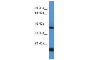 Western Blot showing RHBDD1 antibody used at a concentration of 1-2 ug/ml to detect its target protein. (RHBDD1 antibody  (C-Term))