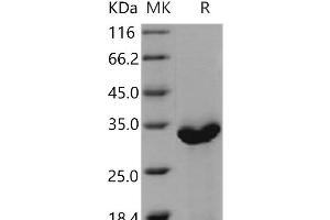 Western Blotting (WB) image for Complement Component 1, Q Subcomponent Binding Protein (C1QBP) protein (His tag) (ABIN7320370) (C1QBP Protein (His tag))