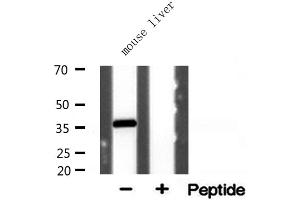 Western blot analysis of extracts from mouse liver, using AKR1CL2 antibody. (AKR1E2 antibody  (Internal Region))