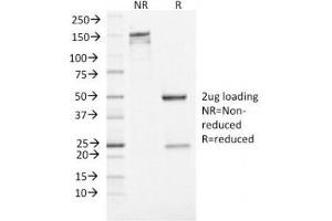 SDS-PAGE Analysis of Purified, BSA-Free Neuron Specific Enolase Antibody (clone ENO2/1462). (ENO2/NSE antibody  (AA 416-433))