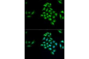 Immunofluorescence analysis of MCF7 cells using KLK4 antibody (ABIN6131853, ABIN6142954, ABIN6142955 and ABIN6222339). (Kallikrein 4 antibody  (AA 30-254))
