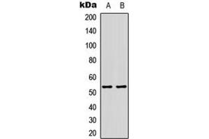 Western blot analysis of p53 (AcK386) expression in HepG2 (A), H9C2 (B) whole cell lysates. (p53 antibody  (acLys386, C-Term))