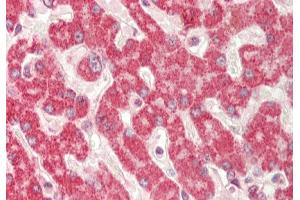 Rabbit Anti-RPN1 antibody  Formalin Fixed Paraffin Embedded Tissue: Human Liver Primary antibody Concentration: 1:100 Secondary Antibody: Donkey anti-Rabbit-Cy3 Secondary Antibody Concentration: 1:200 Magnification: 20x Exposure Time: 0.