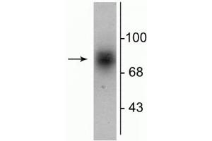 Western blot of human striatal lysate showing specific immunolabeling of the ~88 kDa DAT protein. (SLC6A3 antibody  (C-Term))