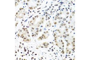 Immunohistochemistry of paraffin-embedded human stomach using IGF2BP1 antibody. (IGF2BP1 antibody  (C-Term))