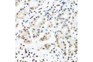 Immunohistochemistry of paraffin-embedded human stomach using IGF2BP1 antibody. (IGF2BP1 antibody  (C-Term))