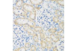 Immunohistochemistry of paraffin-embedded rat kidney using NB antibody (ABIN6132989, ABIN6144383, ABIN6144385 and ABIN6223030) at dilution of 1:200 (40x lens). (NAT8B antibody  (AA 75-165))