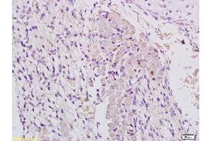 Formalin-fixed and paraffin embedded mouse embryo labeled with Anti-MLK3/RHOE Polyclonal Antibody, Unconjugated (ABIN682573) at 1:200 followed by conjugation to the secondary antibody (MAP3K11 antibody  (AA 355-460))