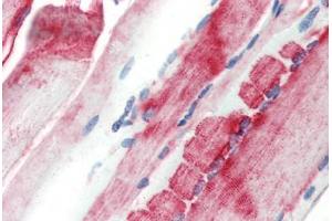 Human Skeletal Muscle (formalin-fixed, paraffin-embedded) stained with CRYAB antibody ABIN462098 at 10 µg/ml followed by biotinylated goat anti-rabbit IgG secondary antibody ABIN481713, alkaline phosphatase-streptavidin and chromogen. (CRYAB antibody)