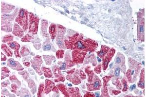 Human Heart (formalin-fixed, paraffin-embedded) stained with KCNH5 antibody ABIN214782 at 5 ug/ml followed by biotinylated goat anti-rabbit IgG secondary antibody ABIN481713, alkaline phosphatase-streptavidin and chromogen. (KCNH5 antibody  (AA 156-205))