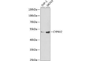 Western blot analysis of extracts of various cell lines, using CYP4V2 Antibody (ABIN6131089, ABIN6139368, ABIN6139369 and ABIN6222250) at 1:1000 dilution. (CYP4V2 antibody  (AA 246-525))