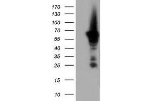 HEK293T cells were transfected with the pCMV6-ENTRY control (Left lane) or pCMV6-ENTRY AK5 (Right lane) cDNA for 48 hrs and lysed. (Adenylate Kinase 5 antibody)