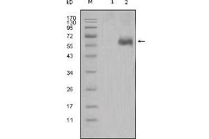 Western blot analysis using DKK1 mouse mAb against HEK293 (1) and DKK1-hIgGFc transfected HEK293 cell lysate (2). (DKK1 antibody)