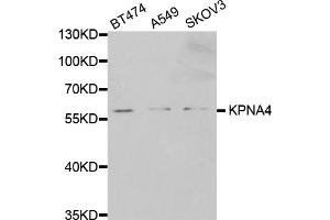 Western blot analysis of extracts of various cell lines, using KPNA4 antibody (ABIN5971058) at 1/1000 dilution. (KPNA4 antibody)